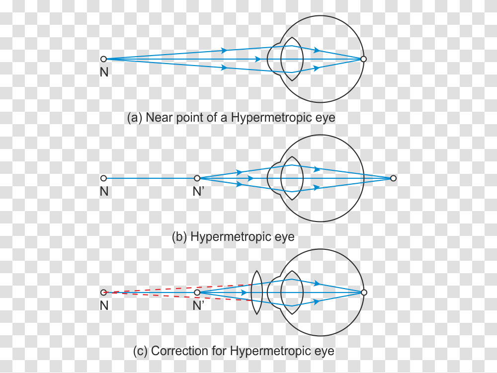 Presbyopia Diagram, Plot, Measurements Transparent Png