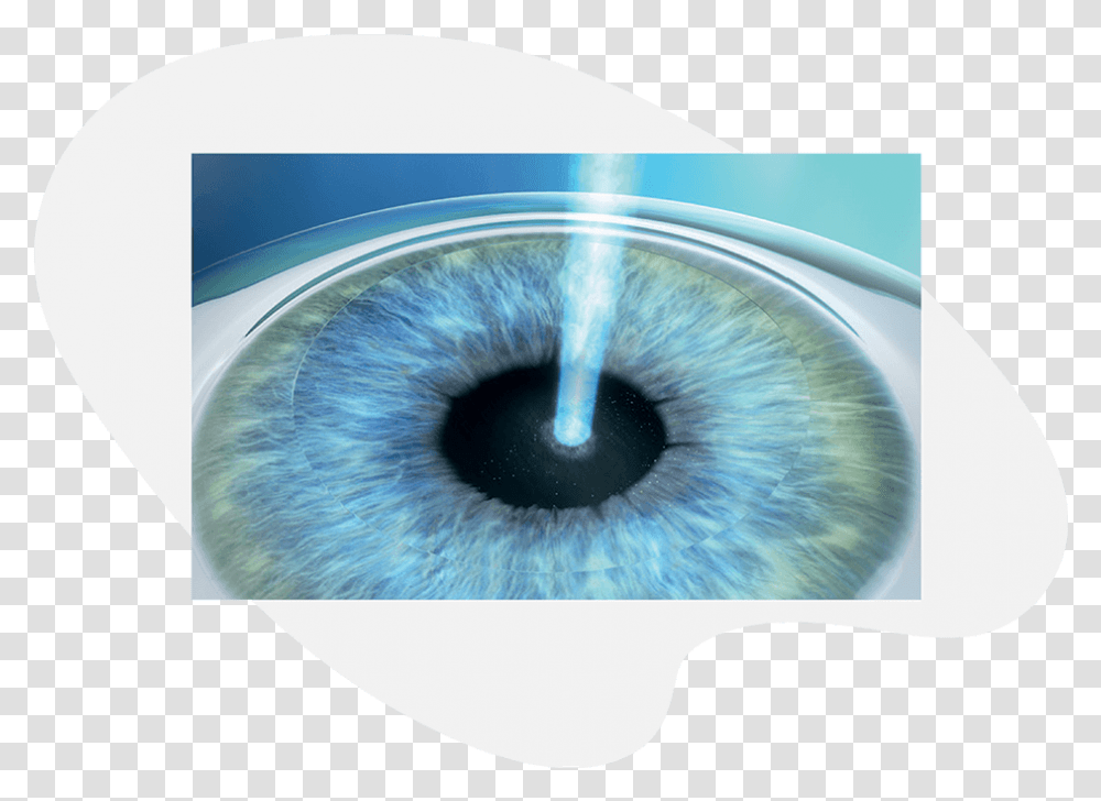 Prk Treatment With Excimer Laser Bandage Contact Lens After Prk, Cat, Animal, Hole, Photography Transparent Png