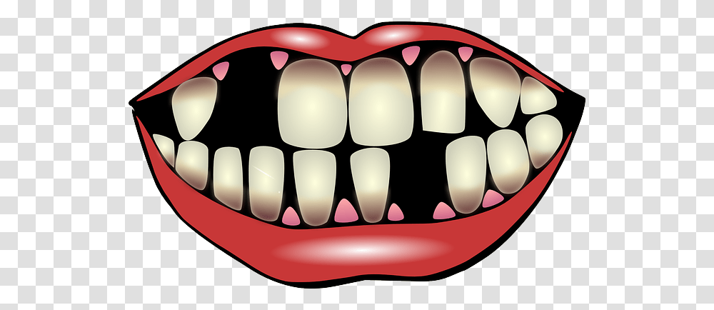 Progeria Treatment Clip Art Cliparts, Teeth, Mouth, Jaw Transparent Png