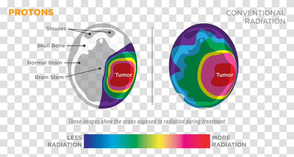 Proton Beam Therapy Diagram, Nature Transparent Png