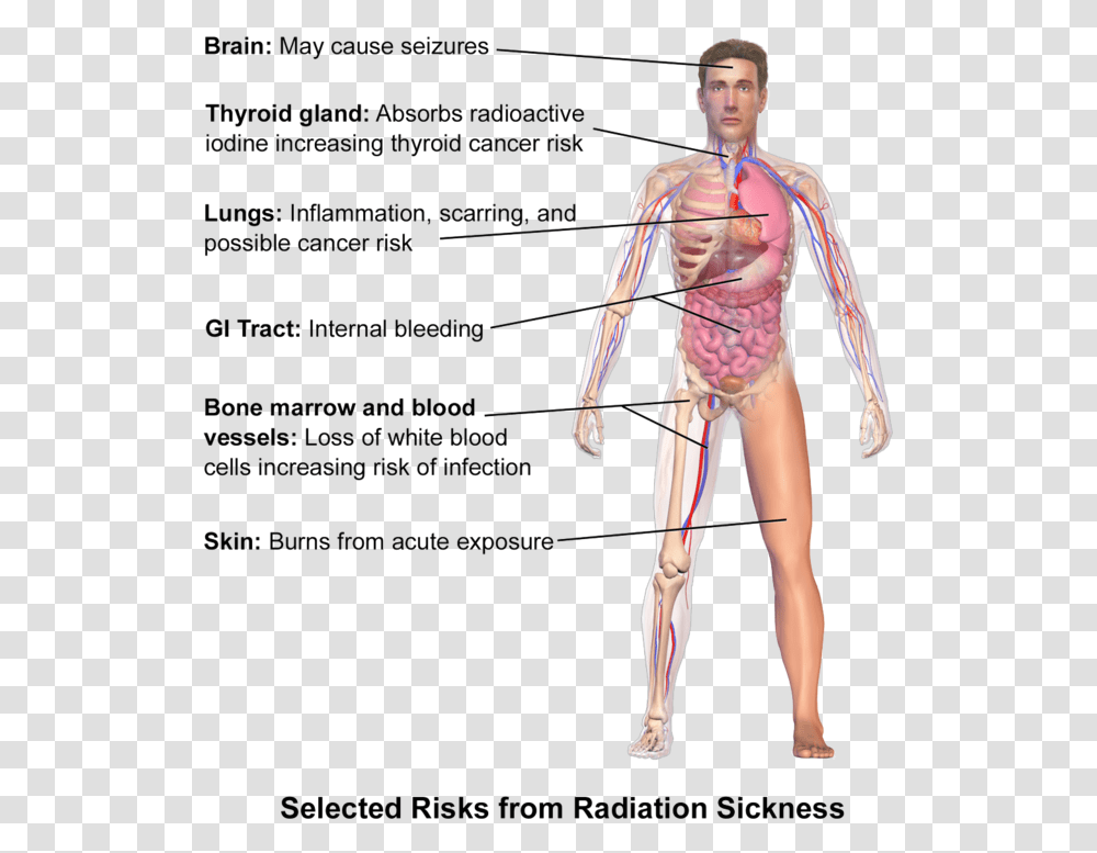 Radiation Poisoning Symptoms, Person, Human, Plot, Diagram Transparent Png