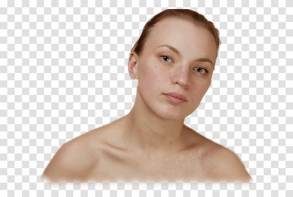 Realistic Scar Barechested, Person, Skin, Neck, Face Transparent Png