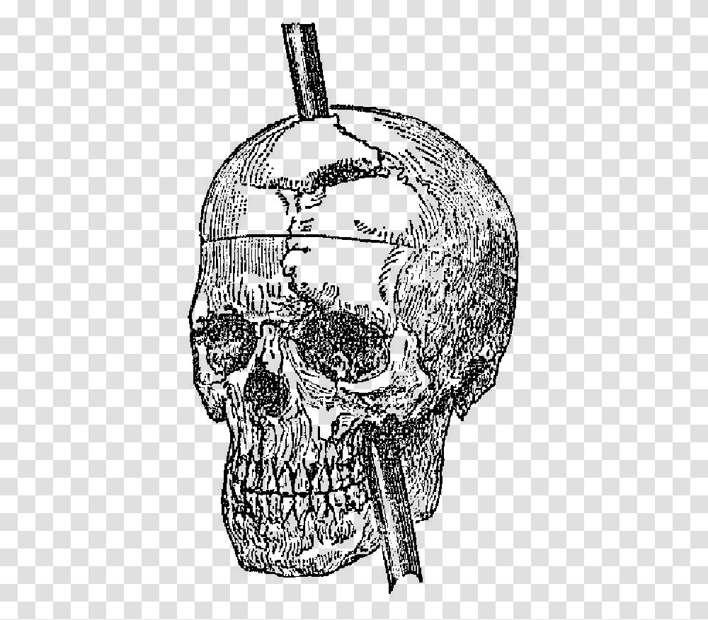 Recovery From The Passage Of An Iron Bar Through The Phineas Gage Skull, Chandelier, Lamp, Drawing Transparent Png