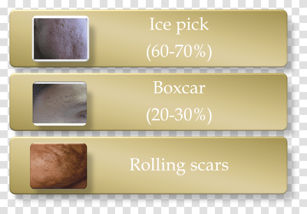 Retina Ice Pick Scars, Mobile Phone, Wood, Purple Transparent Png