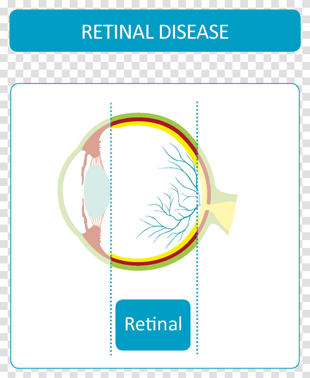 Retinal Diseases Circle, Sphere, Plot, White Board Transparent Png