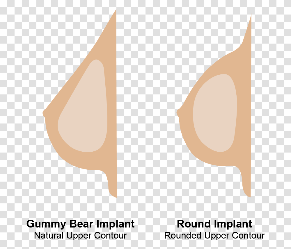 Round And Gummy Bear Implants, Triangle, Sand, Vehicle, Transportation Transparent Png
