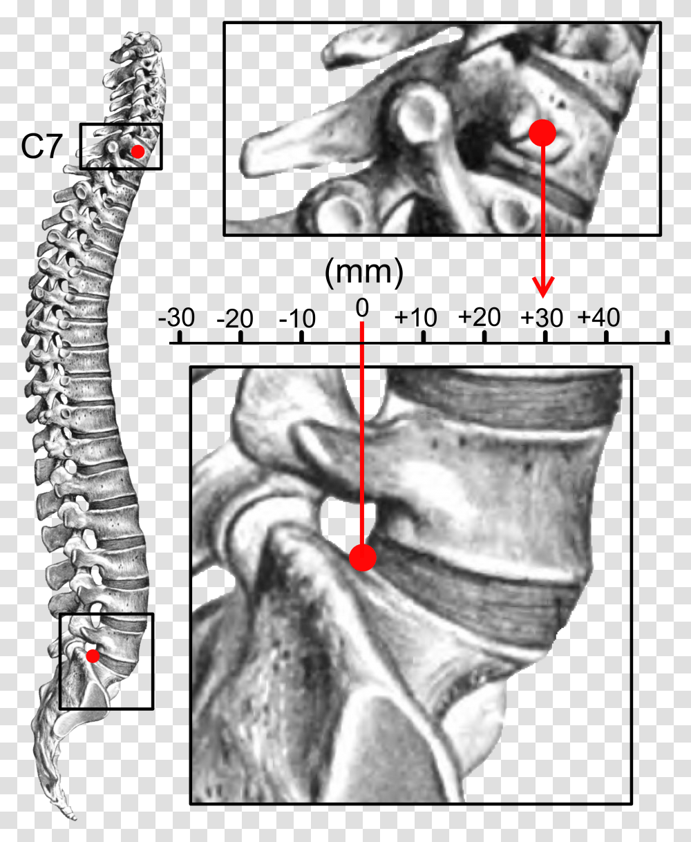 Sagittal Balance Kyphosis, X-Ray, Medical Imaging X-Ray Film, Ct Scan, Person Transparent Png