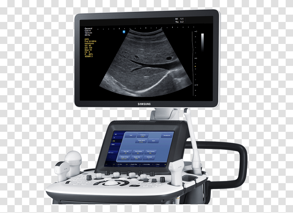 Samsung H60 Ultrasound Machine, Monitor, Screen, Electronics, Laptop Transparent Png