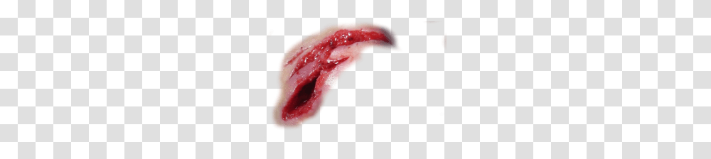 Scar, Person, Mouth, Lip, Teeth Transparent Png
