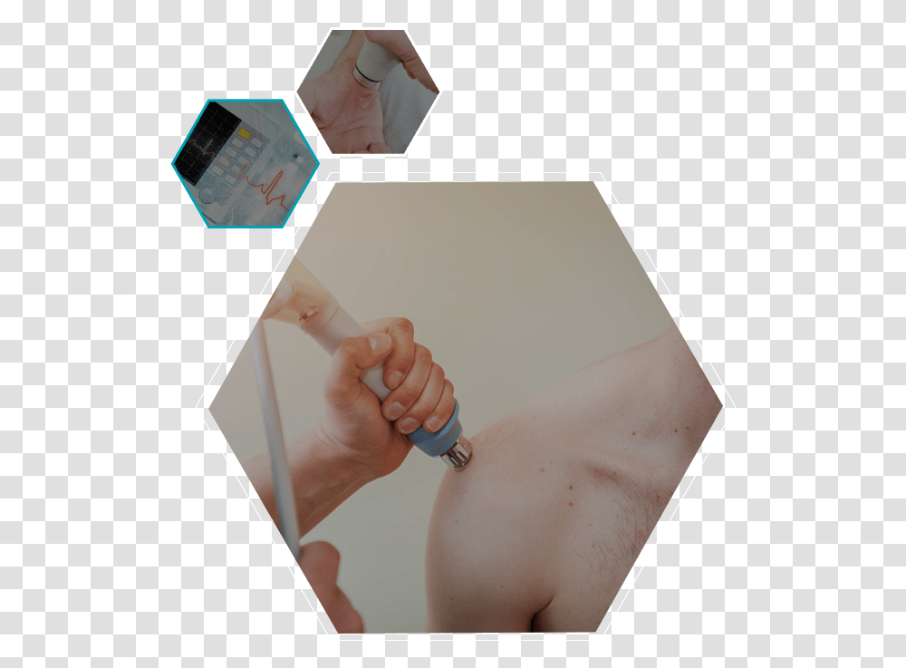 Shock Wave Therapy Art, Arm, Person, Human, Injection Transparent Png