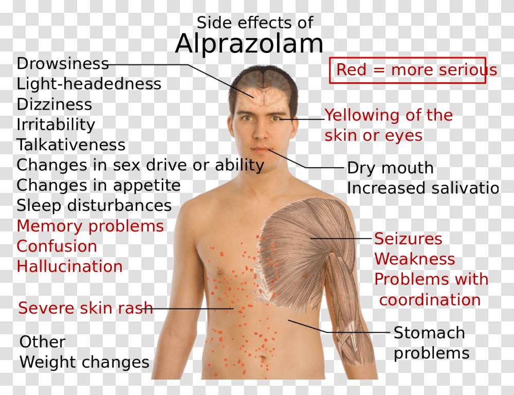 Side Effects Of Alprazolam Que Hace El Alprazolam, Person, Plot, Diagram Transparent Png