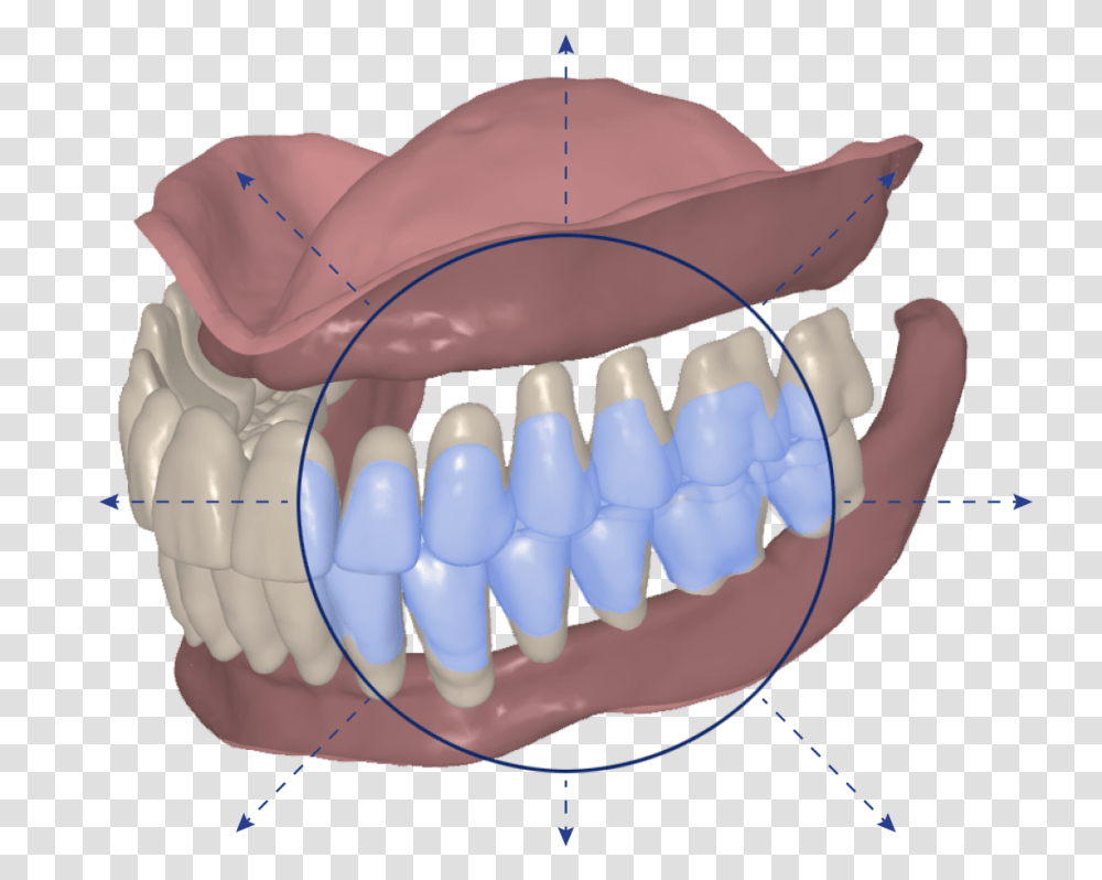Signatureteeth Signature Digital Dentures, Mouth, Lip, Jaw, Balloon Transparent Png
