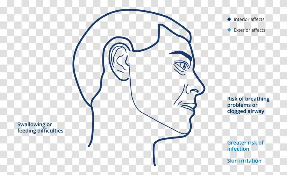 Signs Symptoms And The Affects Of Sialorrhea Sketch, Face, Head Transparent Png