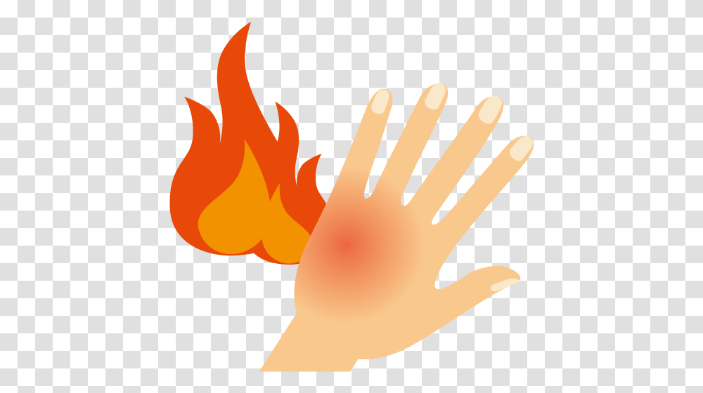 Skin Clipart Burned Food Burned Hand Clipart, Fire, Flame, Wrist, Finger Transparent Png