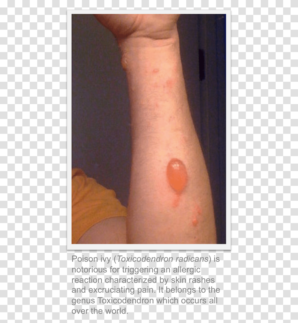 Skin Diseases Caused By Green House Gases, Arm, Wrist, Hand, Person Transparent Png