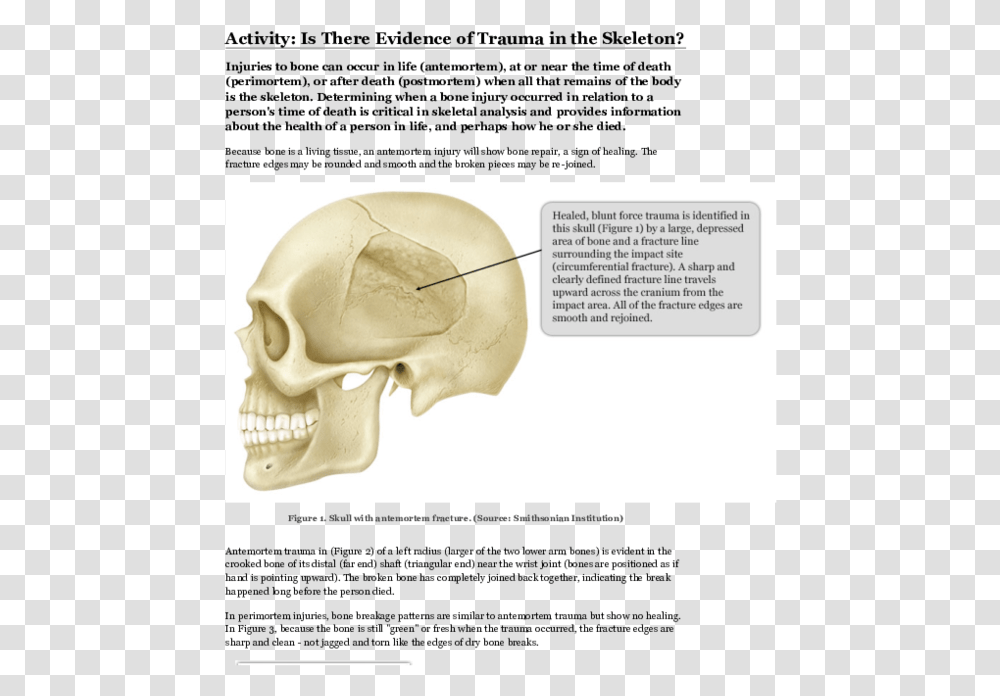 Skull, Injection, Label, Shoulder Transparent Png