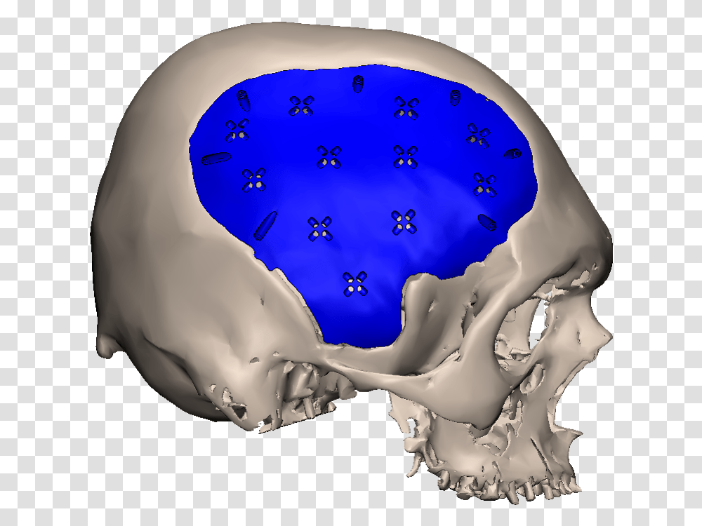 Skull, Jaw, X-Ray, Ct Scan, Medical Imaging X-Ray Film Transparent Png