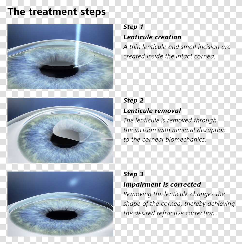 Smile Eye Surgery, Hole, Head, Photography, Building Transparent Png