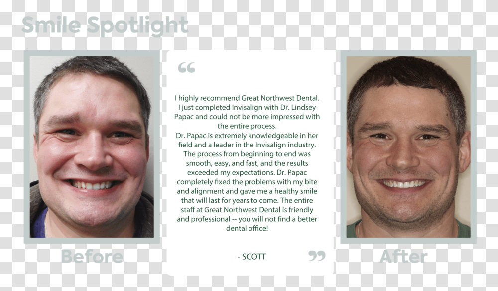 Smile Spotlight Template Invisalign Before And After, Face, Person, Id Cards Transparent Png
