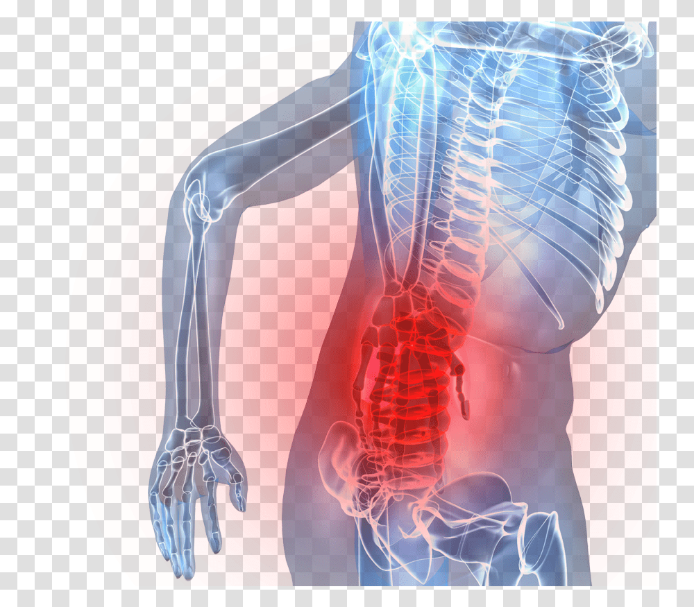 Spinal Cord Low Back Pain, Shoulder, Neck, Skeleton, Torso Transparent Png
