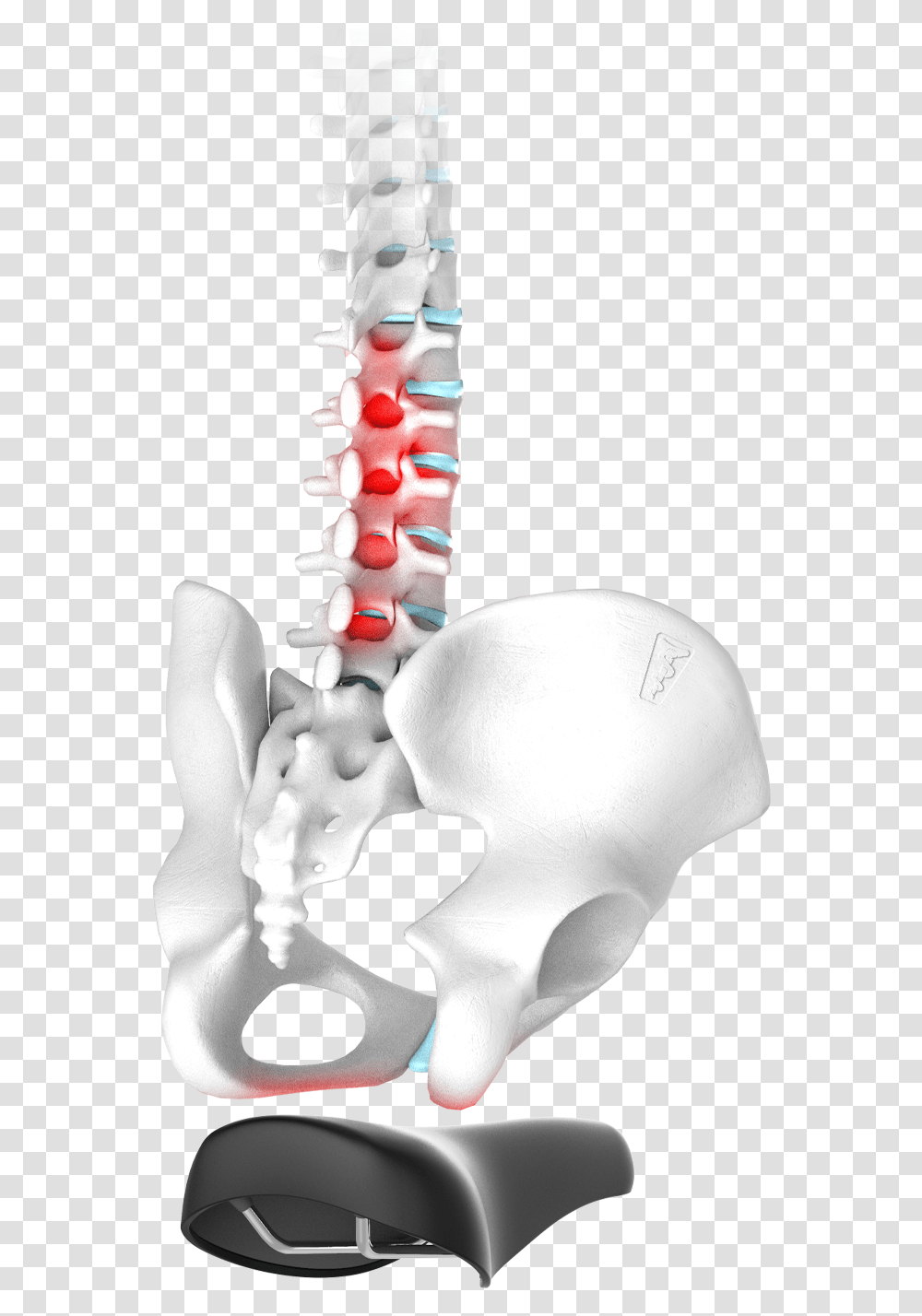 Spinal Disc Problems X Ray, Hip, Skeleton, X-Ray, Ct Scan Transparent Png
