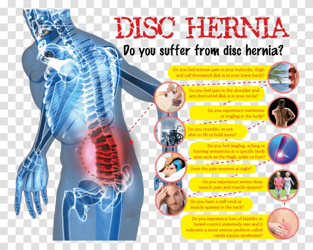 Spine Surgery Infographic, Person, Human, Poster, Advertisement Transparent Png