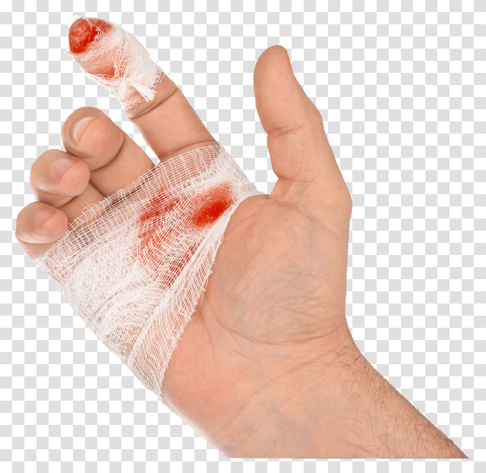 Steel Doctor Blade Injury Cut Hand Cut Download Transparent Png