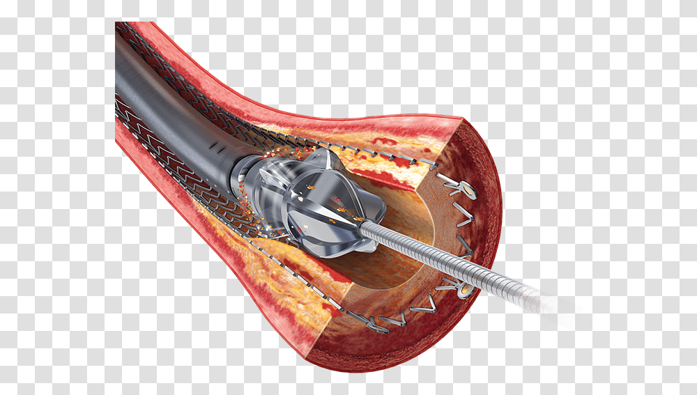 Stent Restenosis, Lobster, Seafood, Sea Life, Animal Transparent Png
