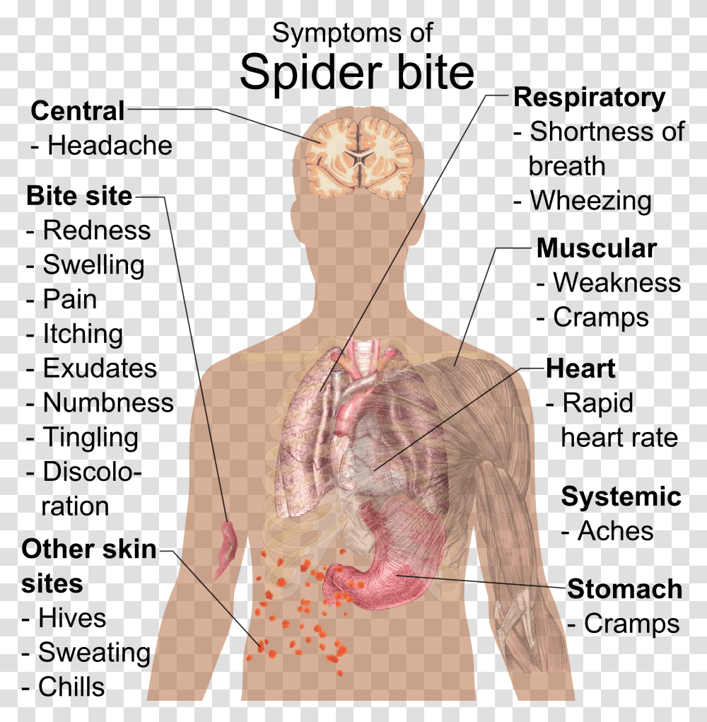 Symptoms Of Spider Bite Importance Of Ph Value In Daily Life, Person, Human, Back Transparent Png