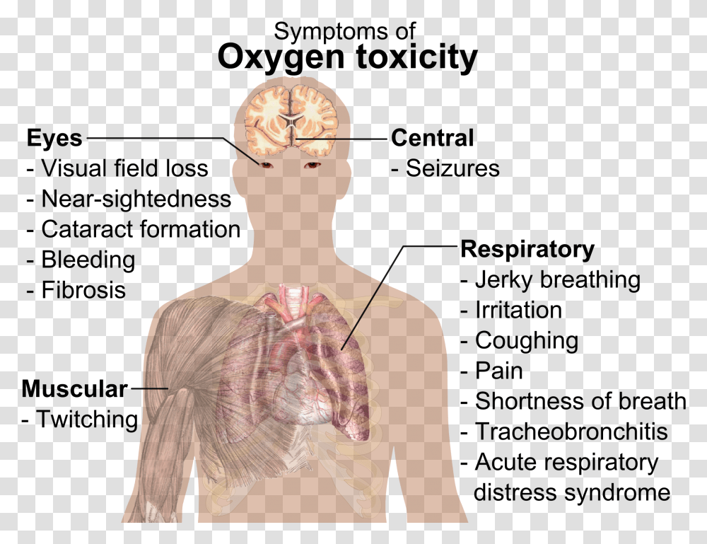 Symptoms Sign And Symptom Of Oxygen Toxicity, Back, Person, Human, Torso Transparent Png