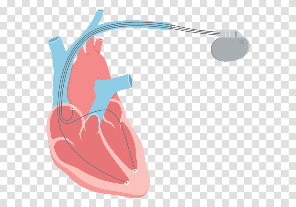 Systolic Heart Failure Also Called Heart Failure Pngs, Bow, Clothing, Apparel Transparent Png
