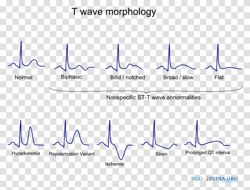 T Wave Abnormality, Alphabet, Outdoors, Plot Transparent Png