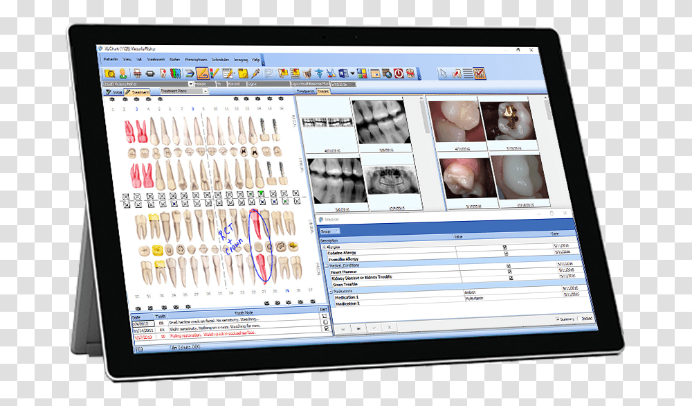 Tablet Mockup 12 19 16 Medical Practice Management Software, Computer, Electronics, Monitor, Screen Transparent Png