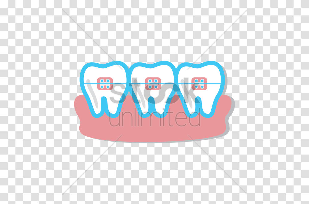 Teeth With Braces Vector Image, Jaw, Mouth, Lip, Furniture Transparent Png