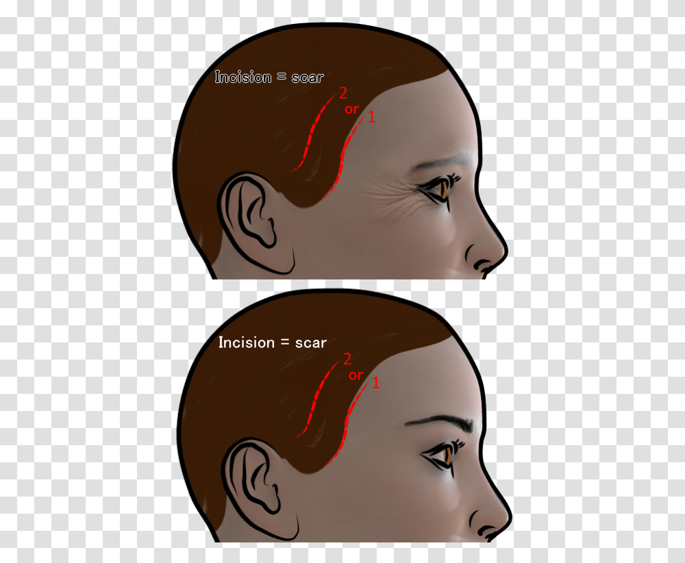 Temporal Lift Cartoon, Head, Face, Helmet Transparent Png