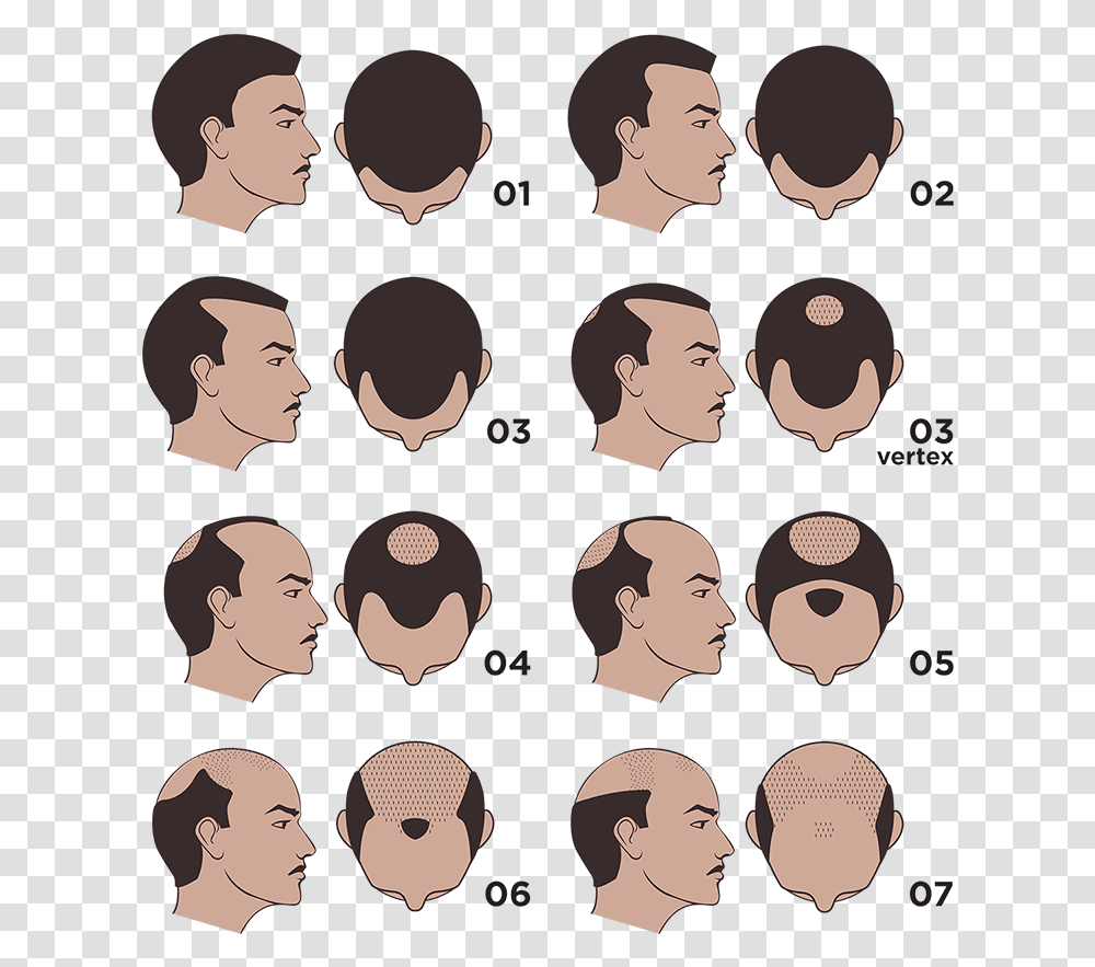 The Norwood Scale, Face, Person, Audience, Crowd Transparent Png