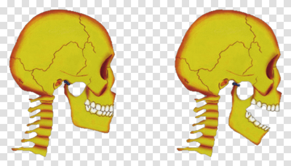 Tmj Disorders Jaw Joint Pain Skull, Sunglasses, Accessories, Accessory, Head Transparent Png