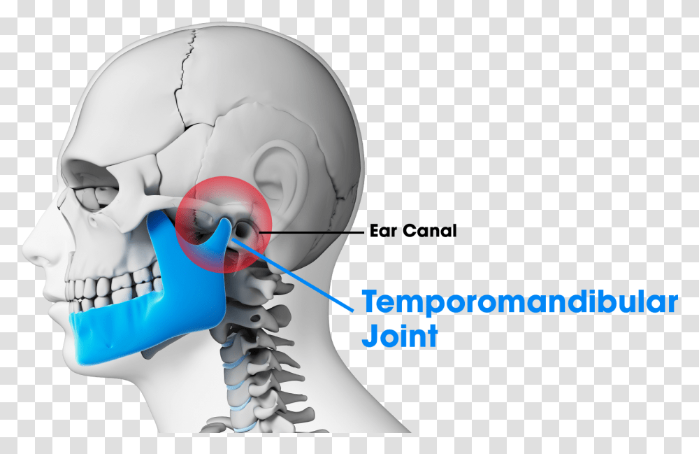 Tmj Treatment Denver Broken Human Jaw Bone, Hip, Helmet, Apparel Transparent Png