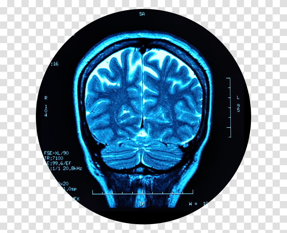 Traumatic Brain Injury Download, X-Ray, Medical Imaging X-Ray Film, Ct Scan, Clock Tower Transparent Png