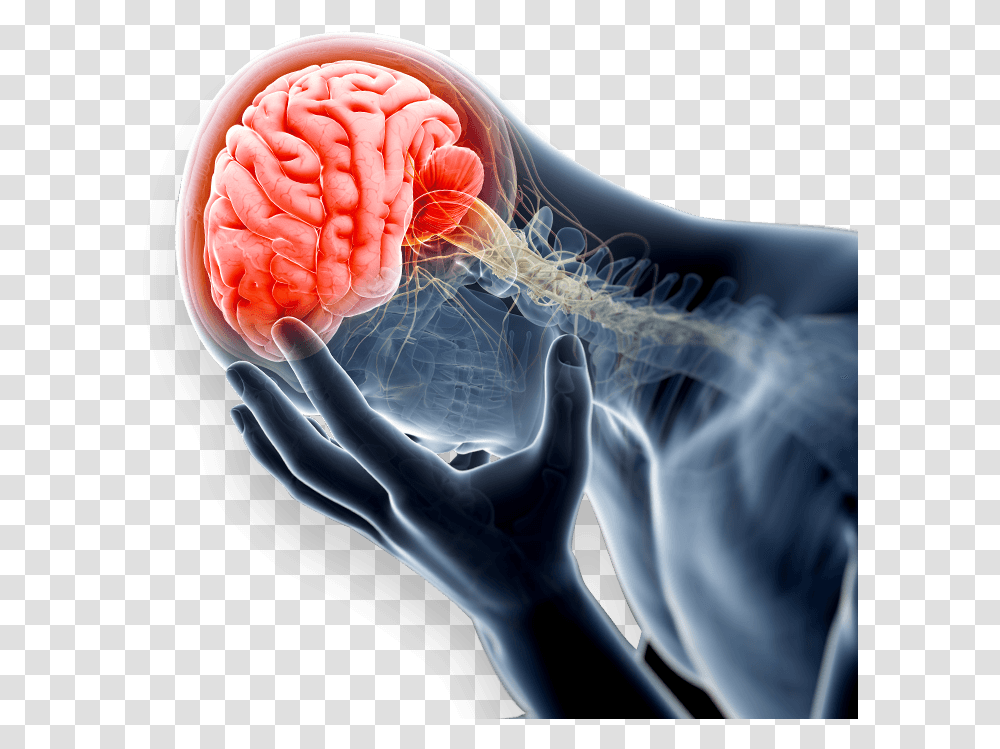 Traumatic Brain Injury Lawyer Get Over It Anxiety, X-Ray, Ct Scan, Medical Imaging X-Ray Film, Person Transparent Png