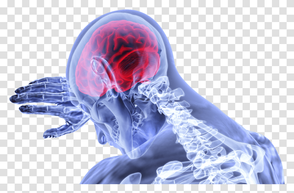 Traumatic Brain Injury, X-Ray, Ct Scan, Medical Imaging X-Ray Film, Person Transparent Png