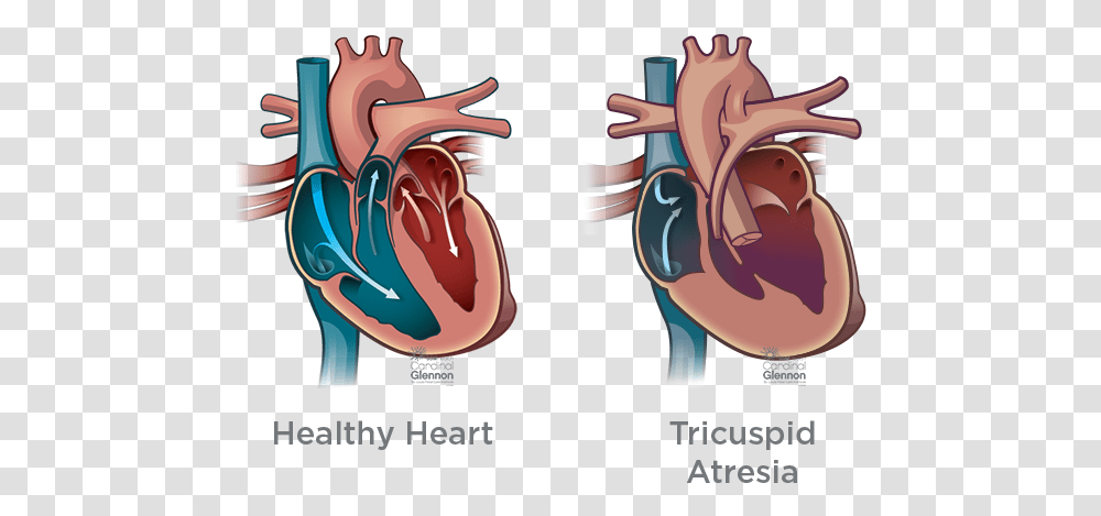 Tricuspatresia Truncus Arteriosus Heart, Mouth, Lip, Teeth, Tongue Transparent Png