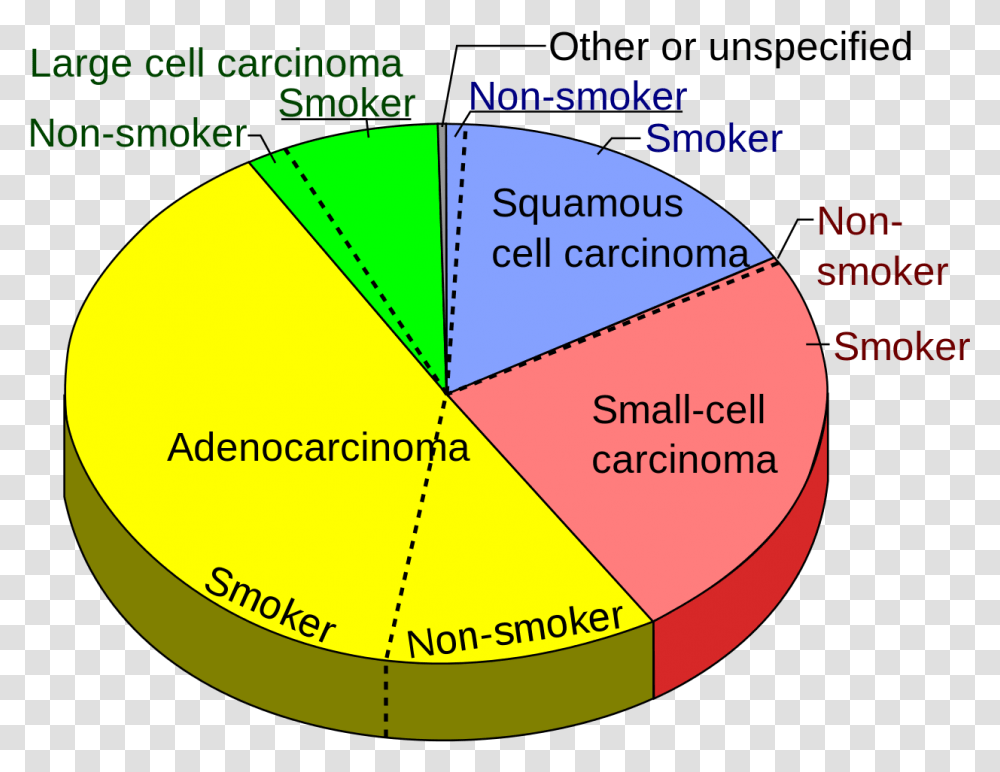 Types Non Small Cell Lung Cancer Lung Cancer Pie Chart, Diagram, Plot, Sphere Transparent Png