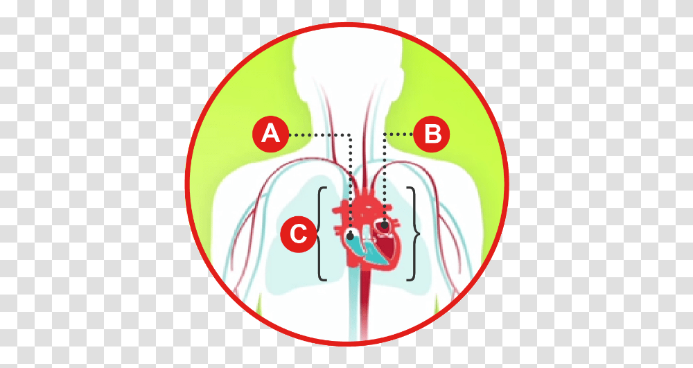 Types Of Heart Failure American Association Insuficiencia Cardiaca Tipos, Logo, Symbol, Trademark, Plot Transparent Png