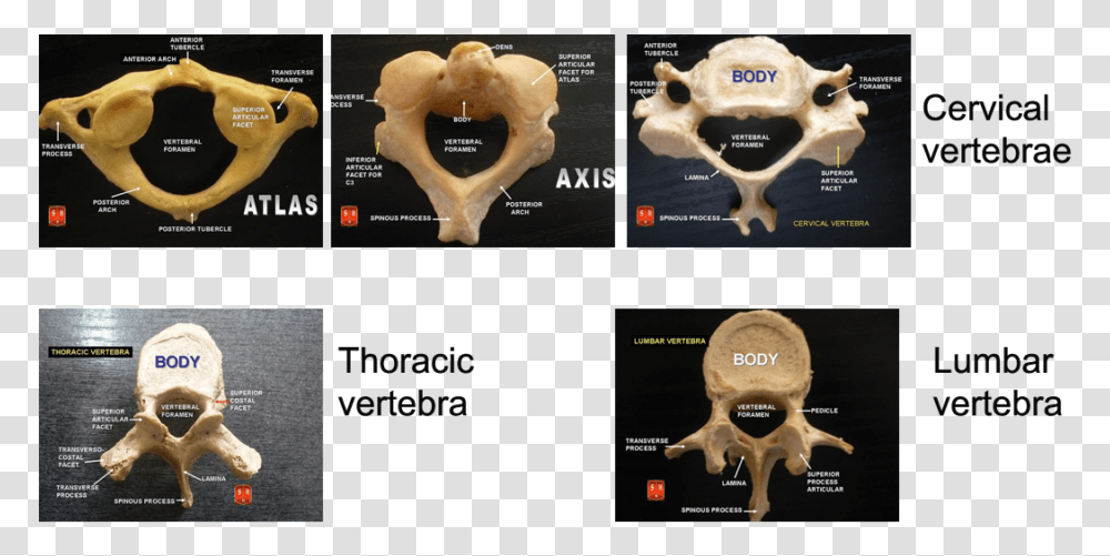 Types Of Vertebrae Anatomy, Hip, Dog, Canine, Animal Transparent Png