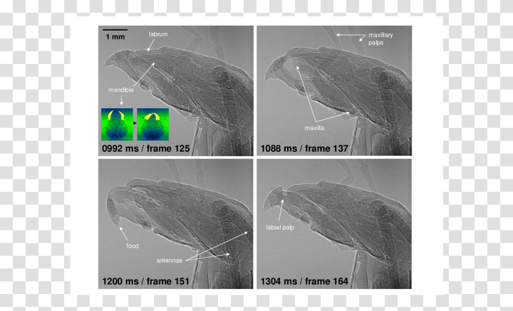 Umbrella, X-Ray, Ct Scan, Medical Imaging X-Ray Film, Plot Transparent Png