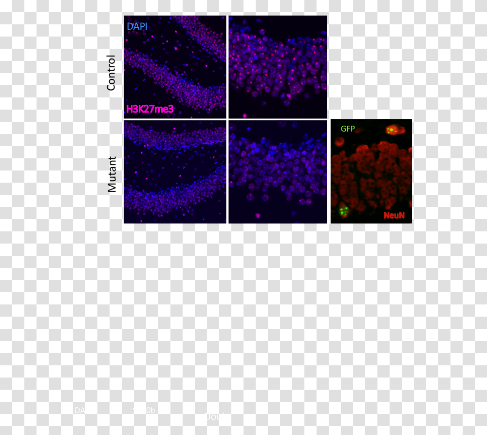 Understanding The Genetics Of X Chromosome Inactivation Graphic Design, Purple, Light, Graphics, Art Transparent Png
