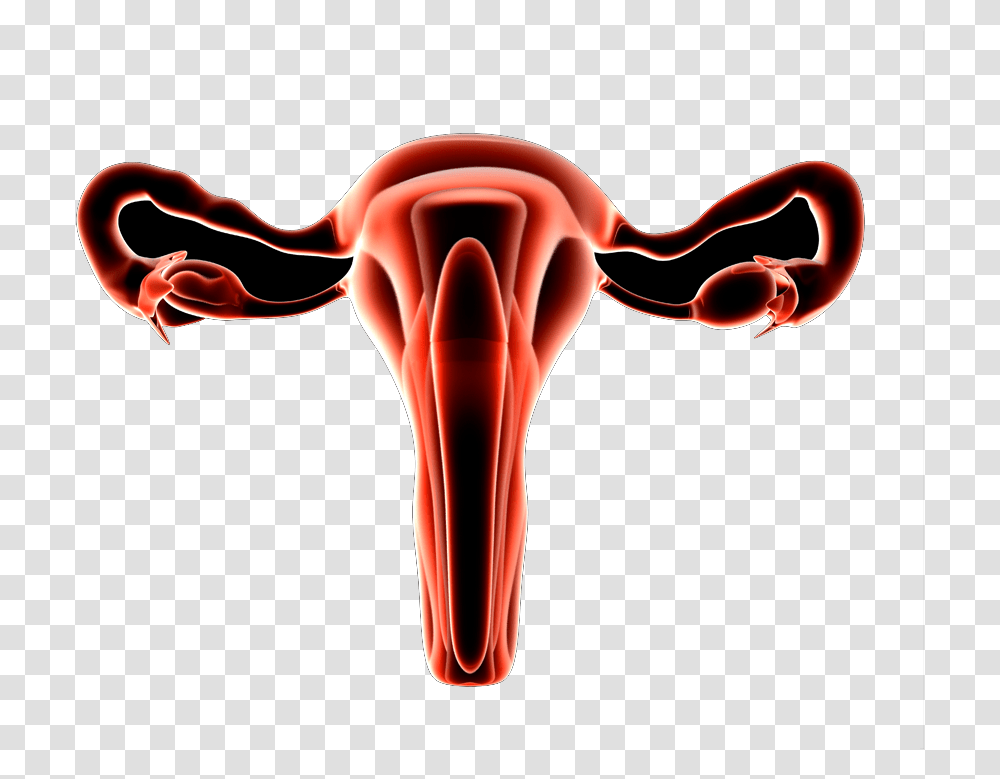 Uterine Fibroids Adenomyosis Illustration, Animal, Blow Dryer, Appliance, Hair Drier Transparent Png