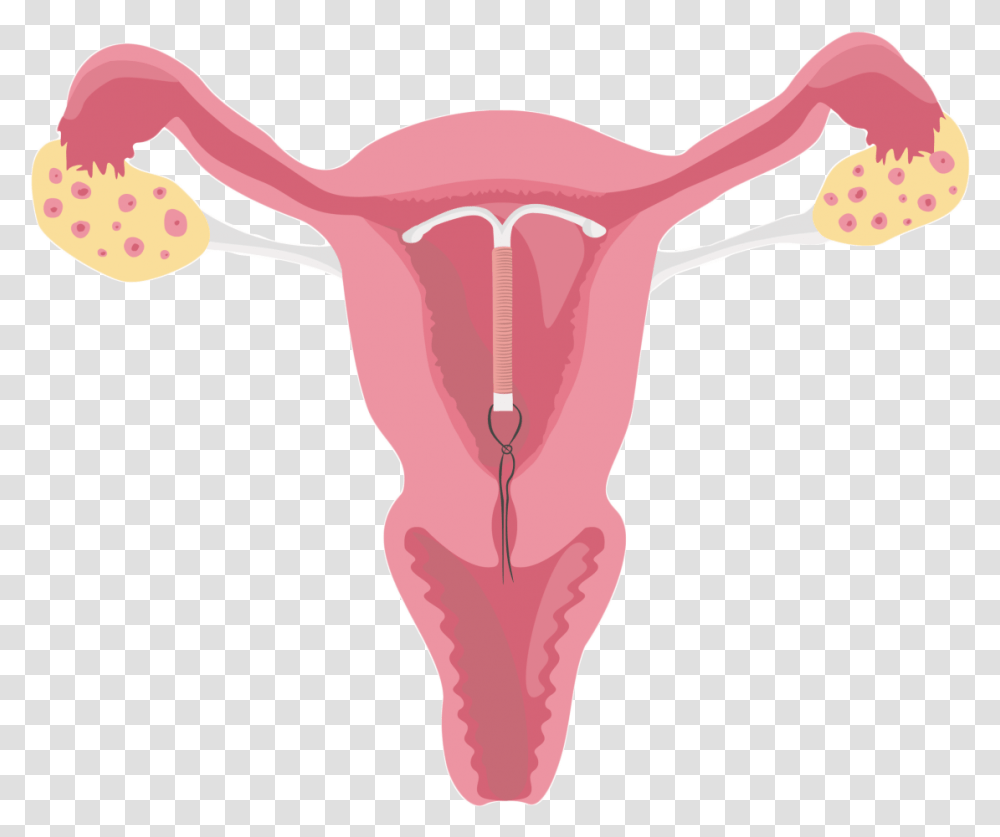 Uterus Female Reproductive System With Iud, Hip, Stomach, Torso Transparent Png