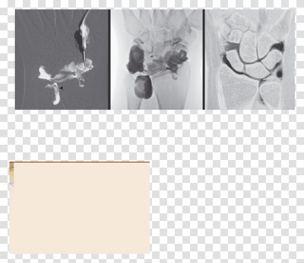 Visual Arts, Leisure Activities, Bird, Animal, X-Ray Transparent Png